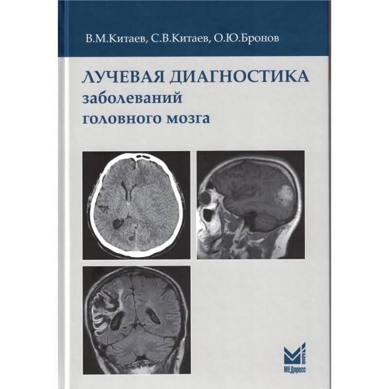 Лучевая диагностика заболеваний головного мозга