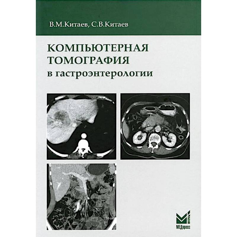 Компьютерная томография в гастроэнтерологии: руководство для врачей.