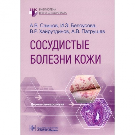 Медицина. Фармакология, книга Сосудистые болезни кожи купить по скидке
