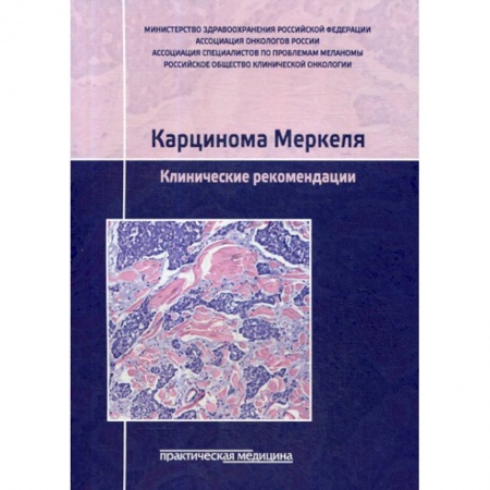 Онкология, книга Карцинома Меркеля. Клинические рекомендации купить по скидке