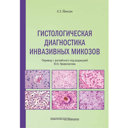 Гистология. Эмбриология. Цитология, книга Гистологическая диагностика инвазивных микозов купить по скидке