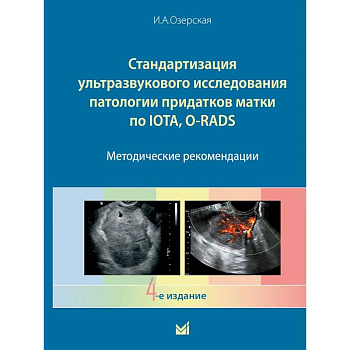 Стандартизация ультразвукового исследования патологии придатков матки по IOTA, O-RADS. Методические рекомендации. 4-е издание