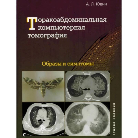 Специальная медицина, книга Торакоабдоминальная компьютерная томография. Образы и симптомы купить по скидке
