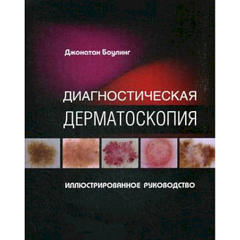 Диагностическая дерматоскопия. Иллюстрированное руководство