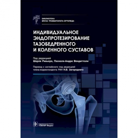 Книги, книга Индивидуальное эндопротезирование тазобедренного и коленного суставов купить по скидке