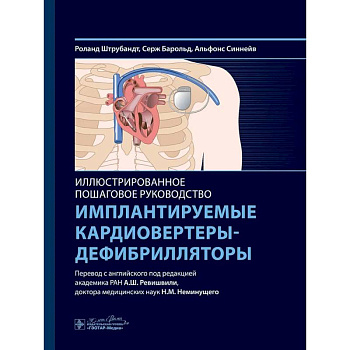 Имплантируемые кардиовертеры-дефибрилляторы. Иллюстрированное пошаговое руководство